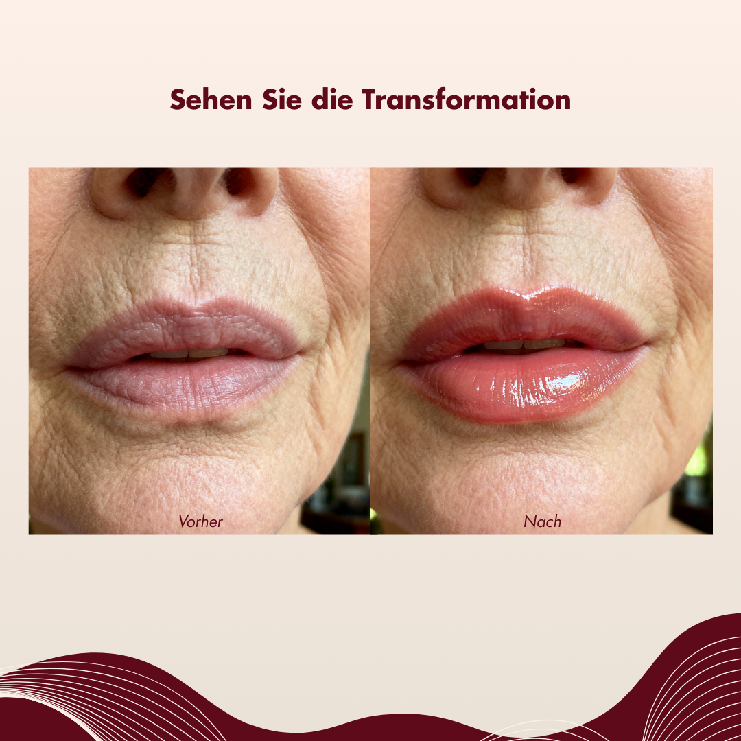 Vorher und nachher: Lippen mit Reveliane